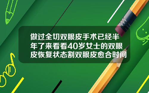 做过全切双眼皮手术已经半年了来看看40岁女士的双眼皮恢复状态割双眼皮愈合时间多久