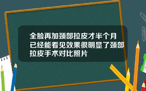 全脸再加颈部拉皮才半个月已经能看见效果很明显了颈部拉皮手术对比照片