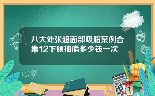八大处张超面部吸脂案例合集12下颌抽脂多少钱一次