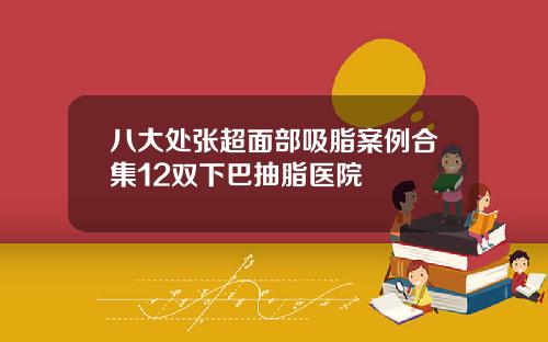 八大处张超面部吸脂案例合集12双下巴抽脂医院