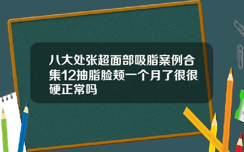 八大处张超面部吸脂案例合集12抽脂脸颊一个月了很很硬正常吗