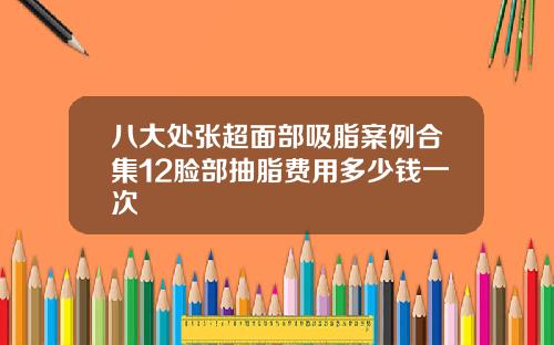 八大处张超面部吸脂案例合集12脸部抽脂费用多少钱一次