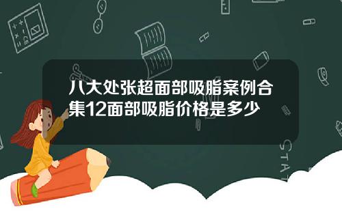 八大处张超面部吸脂案例合集12面部吸脂价格是多少