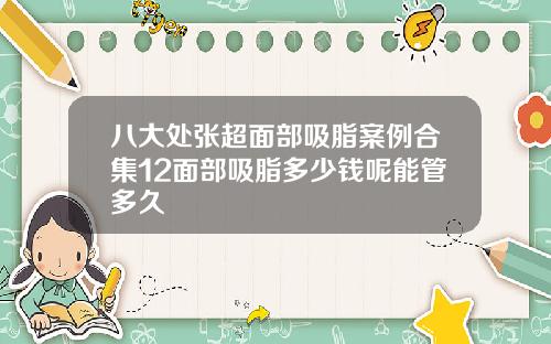 八大处张超面部吸脂案例合集12面部吸脂多少钱呢能管多久