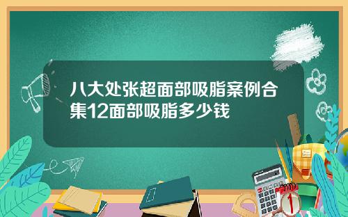 八大处张超面部吸脂案例合集12面部吸脂多少钱