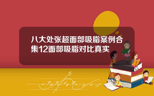 八大处张超面部吸脂案例合集12面部吸脂对比真实