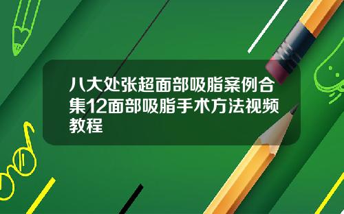 八大处张超面部吸脂案例合集12面部吸脂手术方法视频教程