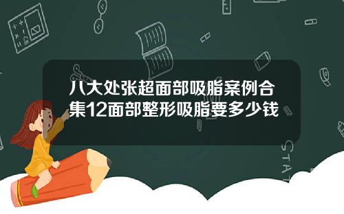 八大处张超面部吸脂案例合集12面部整形吸脂要多少钱