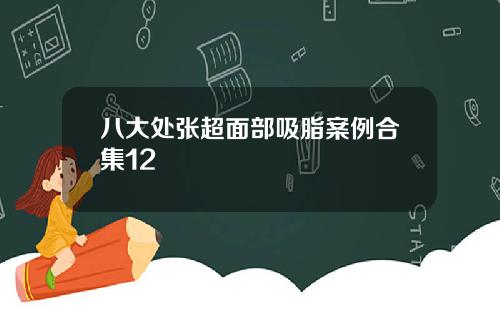 八大处张超面部吸脂案例合集12