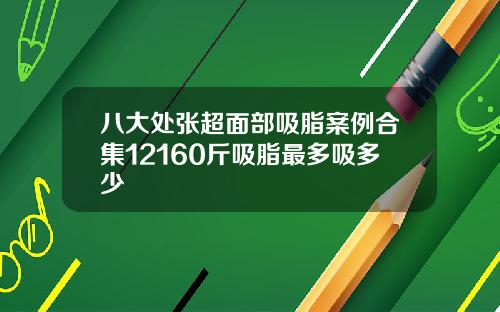 八大处张超面部吸脂案例合集12160斤吸脂最多吸多少