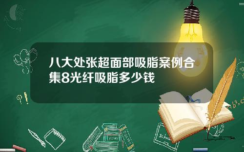 八大处张超面部吸脂案例合集8光纤吸脂多少钱