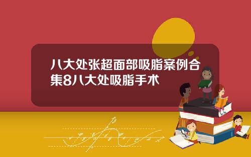 八大处张超面部吸脂案例合集8八大处吸脂手术