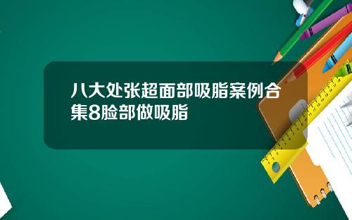 八大处张超面部吸脂案例合集8脸部做吸脂