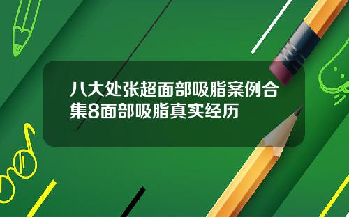 八大处张超面部吸脂案例合集8面部吸脂真实经历