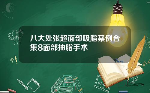 八大处张超面部吸脂案例合集8面部抽脂手术