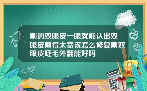 割的双眼皮一眼就能认出双眼皮割得太宽该怎么修复割双眼皮睫毛外翻能好吗