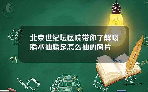 北京世纪坛医院带你了解吸脂术抽脂是怎么抽的图片