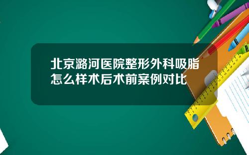 北京潞河医院整形外科吸脂怎么样术后术前案例对比
