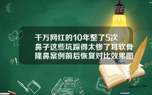 千万网红的10年整了5次鼻子这些坑踩得太惨了耳软骨隆鼻案例前后恢复对比效果图