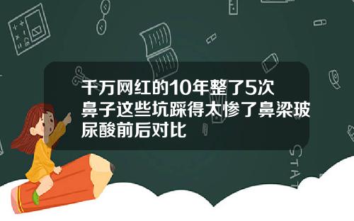 千万网红的10年整了5次鼻子这些坑踩得太惨了鼻梁玻尿酸前后对比