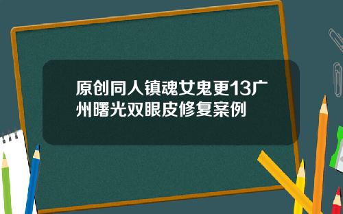 原创同人镇魂女鬼更13广州曙光双眼皮修复案例