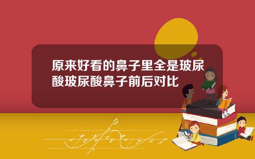 原来好看的鼻子里全是玻尿酸玻尿酸鼻子前后对比