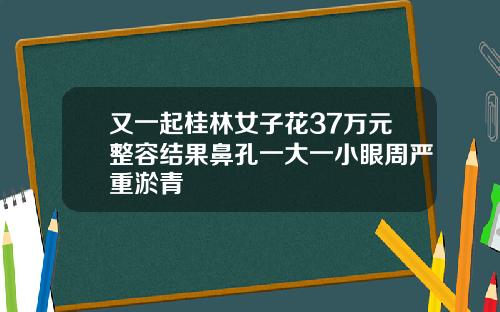 又一起桂林女子花37万元整容结果鼻孔一大一小眼周严重淤青