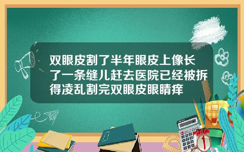 双眼皮割了半年眼皮上像长了一条缝儿赶去医院已经被拆得凌乱割完双眼皮眼睛痒
