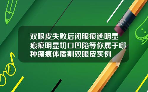 双眼皮失败后闭眼痕迹明显瘢痕明显切口凹陷等你属于哪种瘢痕体质割双眼皮实例