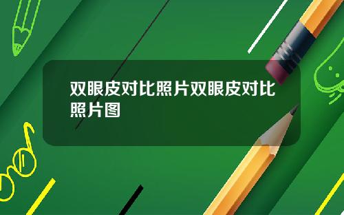 双眼皮对比照片双眼皮对比照片图