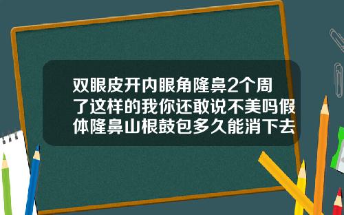 双眼皮开内眼角隆鼻2个周了这样的我你还敢说不美吗假体隆鼻山根鼓包多久能消下去啊