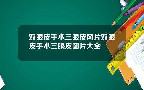 双眼皮手术三眼皮图片双眼皮手术三眼皮图片大全