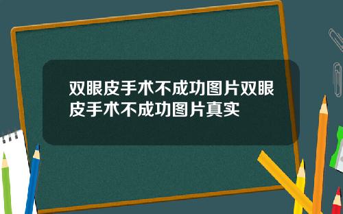 双眼皮手术不成功图片双眼皮手术不成功图片真实