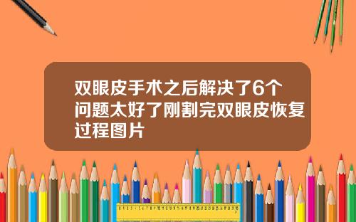 双眼皮手术之后解决了6个问题太好了刚割完双眼皮恢复过程图片