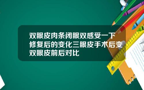 双眼皮肉条闭眼双感受一下修复后的变化三眼皮手术后变双眼皮前后对比