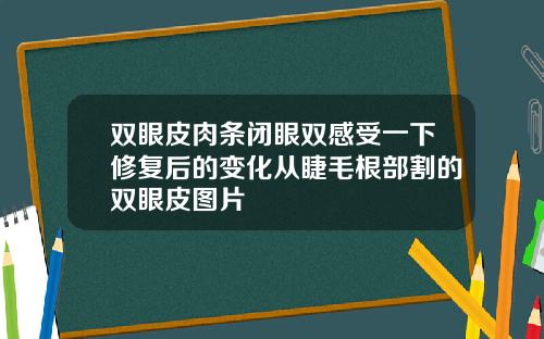 双眼皮肉条闭眼双感受一下修复后的变化从睫毛根部割的双眼皮图片