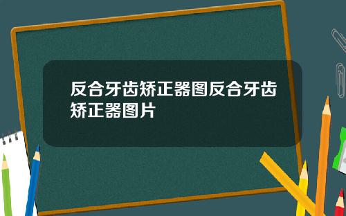反合牙齿矫正器图反合牙齿矫正器图片