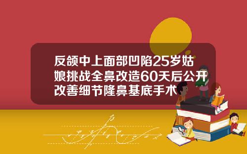 反颌中上面部凹陷25岁姑娘挑战全鼻改造60天后公开改善细节隆鼻基底手术