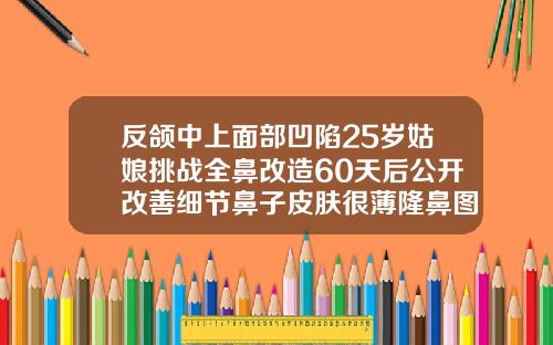 反颌中上面部凹陷25岁姑娘挑战全鼻改造60天后公开改善细节鼻子皮肤很薄隆鼻图片大全