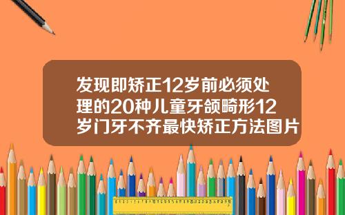 发现即矫正12岁前必须处理的20种儿童牙颌畸形12岁门牙不齐最快矫正方法图片