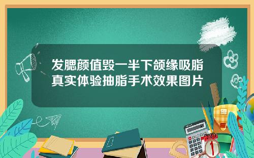 发腮颜值毁一半下颌缘吸脂真实体验抽脂手术效果图片