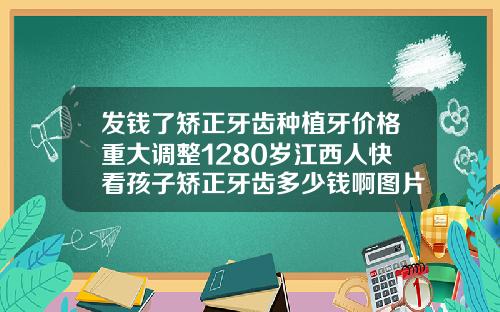 发钱了矫正牙齿种植牙价格重大调整1280岁江西人快看孩子矫正牙齿多少钱啊图片