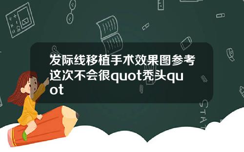 发际线移植手术效果图参考这次不会很quot秃头quot