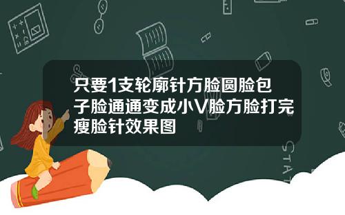 只要1支轮廓针方脸圆脸包子脸通通变成小V脸方脸打完瘦脸针效果图