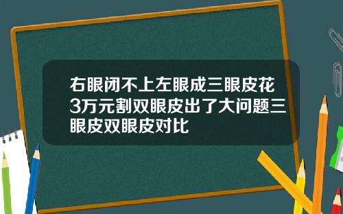 右眼闭不上左眼成三眼皮花3万元割双眼皮出了大问题三眼皮双眼皮对比