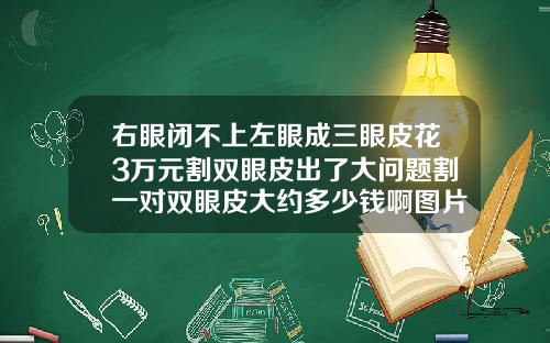 右眼闭不上左眼成三眼皮花3万元割双眼皮出了大问题割一对双眼皮大约多少钱啊图片