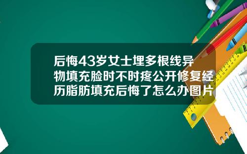 后悔43岁女士埋多根线异物填充脸时不时疼公开修复经历脂肪填充后悔了怎么办图片