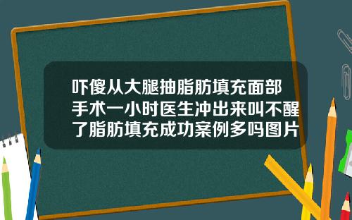 吓傻从大腿抽脂肪填充面部手术一小时医生冲出来叫不醒了脂肪填充成功案例多吗图片