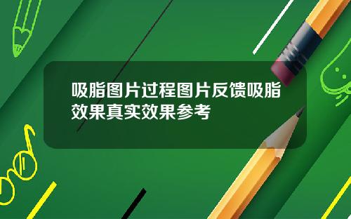 吸脂图片过程图片反馈吸脂效果真实效果参考