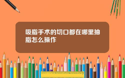 吸脂手术的切口都在哪里抽脂怎么操作